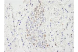 Immunohistochemistry (IHC) image for anti-Suppressor of Ty 6 Homolog (SUPT6H) (AA 425-475) antibody (ABIN7448820) (Spt6 anticorps  (AA 425-475))