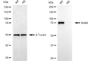 Western blotting analysis using SUN2 antibody (ABIN7800269).