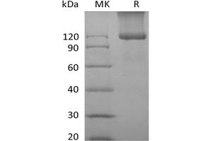 Western Blotting (WB) image for Transforming Growth Factor, beta Receptor III (TGFBR3) protein (His tag) (ABIN7320903)