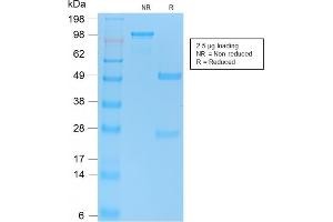 SDS-PAGE Analysis Purified p53 Recombinant Rabbit Monoclonal Antibody (TP53/2092R).