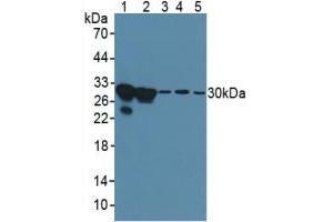 Rabbit Detection antibody from the kit in WB with Positive Control: Human hela cells. (Galectin 3 Kit ELISA)