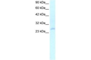 Western Blotting (WB) image for anti-Homeobox C4 (HOXC4) antibody (ABIN2460333)