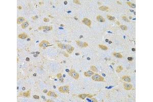 Immunohistochemistry of paraffin-embedded Rat brain using BNIP1 Polyclonal Antibody at dilution of 1:100 (40x lens).