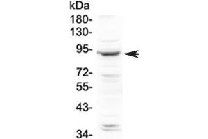 Western blot testing of human HeLa cell lysate with PLA2G6 antibody at 0. (PLA2G6 anticorps  (AA 715-802))