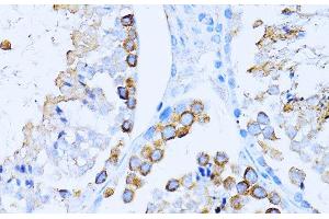 Immunohistochemistry of paraffin-embedded Mouse testis using CD63 Polyclonal Antibody at dilution of 1:100 (40x lens). (CD63 anticorps)
