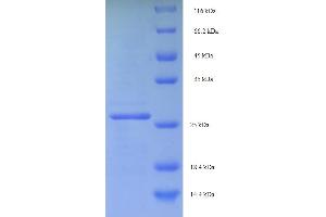 SDS-PAGE (SDS) image for C-Myc Binding Protein (MYCBP) (AA 2-103) protein (His-SUMO Tag) (ABIN5711725)