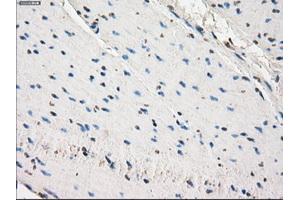 Immunohistochemical staining of paraffin-embedded prostate tissue using anti-SLC2A6mouse monoclonal antibody. (SLC2A6 anticorps)