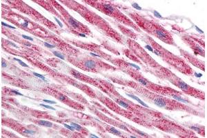 Human Heart (formalin-fixed, paraffin-embedded) stained with TUBB antibody ABIN239815 at 5 ug/ml followed by biotinylated anti-mouse IgG secondary antibody ABIN481714, alkaline phosphatase-streptavidin and chromogen. (TUBB anticorps)