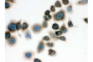 IHC analysis of TCP1 delta using anti-TCP1 delta antibody .