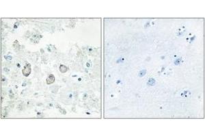Immunohistochemistry analysis of paraffin-embedded human brain tissue, using DOK7 Antibody. (DOK7 anticorps  (AA 10-59))