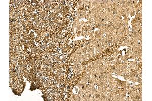 ABIN7094417 and ABIN7098464 at 1/100 staining Rat brain tissue by IHC-P. (NEFH anticorps  (N-Term))