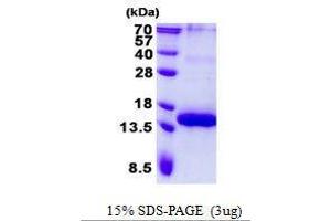 Figure annotation denotes ug of protein loaded and % gel used. (BCMA Protéine)