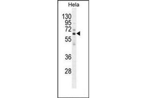 Western blot analysis of HYAL2 Antibody (C-term) in Hela cell line lysates (35ug/lane). (HYAL2 anticorps  (C-Term))