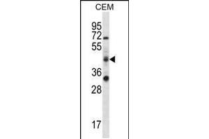 Western blot analysis in CEM cell line lysates (35ug/lane). (RBM42 anticorps  (C-Term))