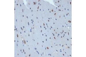 Immunohistochemistry of paraffin-embedded mouse heart using SUN2 Rabbit mAb (ABIN7270135) at dilution of 1:100 (40x lens). (SUN2 anticorps)