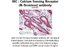 Image no. 1 for anti-Calcium-Sensing Receptor (CASR) (N-Term) antibody (ABIN2852376)