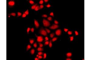 Immunofluorescence analysis of A549 cell using MLF1 antibody. (MLF1 anticorps)