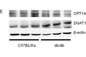 miR-30c-5p expression and triglyceride accumulation in db/db mice(A) Relative expression of miR-30c-5p among different organs.