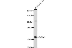 Western blot analysis of extracts of mouse pancreas, using Slc31a2 antibody (ABIN7270450) at 1:500 dilution. (SLC31A2 anticorps  (AA 1-100))