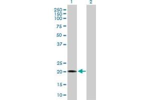 Western Blot analysis of RBBP9 expression in transfected 293T cell line by RBBP9 MaxPab polyclonal antibody. (RBBP9 anticorps  (AA 1-186))