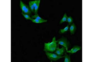 Immunofluorescent analysis of Hela cells using ABIN7144675 at dilution of 1:100 and Alexa Fluor 488-congugated AffiniPure Goat Anti-Rabbit IgG(H+L)