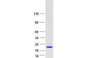 Validation with Western Blot