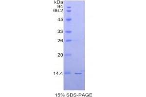 SDS-PAGE analysis of Human PIN4 Protein. (PIN4 Protéine)