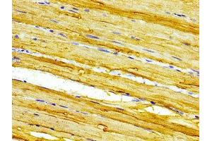 Immunohistochemistry of paraffin-embedded human skeletal muscle tissue using ABIN7146585 at dilution of 1:100 (CASQ2 anticorps  (AA 219-300))