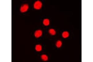 Immunofluorescent analysis of KLF1/5/7 staining in Jurkat cells. (KLF1/5/7 anticorps  (C-Term))