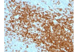 Formalin-fixed, paraffin-embedded human Tonsil stained with CD43 Mouse Monoclonal Antibody (SPN/1094). (CD43 anticorps)