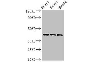 Western Blot Positive WB detected in: Rat heart tissue, Mouse heart tissue, Mouse brain tissue All lanes: NPSR1 antibody at 4 μg/mL Secondary Goat polyclonal to rabbit IgG at 1/50000 dilution Predicted band size: 43, 36, 45, 44, 42, 19, 16, 17, 11 kDa Observed band size: 43 kDa (NPSR1 anticorps  (AA 1-52))
