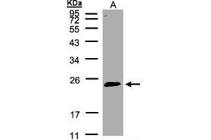 WB Image Sample(30 μg of whole cell lysate) A:HeLa S3, 12% SDS PAGE antibody diluted at 1:500 (RAB2A anticorps  (C-Term))