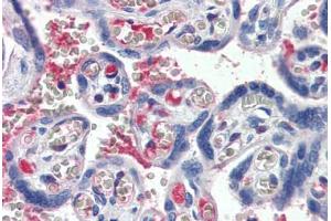 Human Placenta (formalin-fixed, paraffin-embedded) stained with C1S antibody ABIN364242 at 5 ug/ml followed by biotinylated anti-goat IgG secondary antibody ABIN481715, alkaline phosphatase-streptavidin and chromogen.
