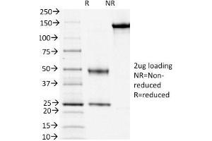 SDS-PAGE Analysis Purified CD3e Mouse Monoclonal Antibody (OKT3).