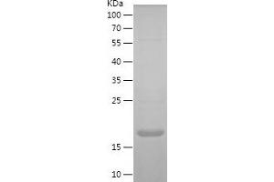 Western Blotting (WB) image for Poliovirus Receptor-Related 2 (Herpesvirus Entry Mediator B) (PVRL2) (AA 43-182) protein (His tag) (ABIN7124501)