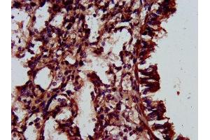 IHC image of ABIN7151530 diluted at 1:500 and staining in paraffin-embedded human lung tissue performed on a Leica BondTM system. (ELMOD3 anticorps  (AA 1-102))