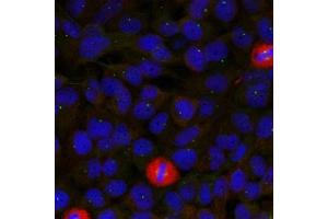 Immunofluorescence staining of methanol-fixed Hela cells using eIF4G(Ab-1232) Antibody.