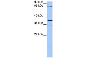 WB Suggested Anti-NLGN4X Antibody Titration:  0. (Neuroligin 4 anticorps  (N-Term))