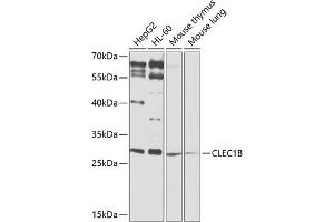 Western blot analysis of extracts of various cell lines, using CLEC1B antibody (ABIN6130012, ABIN6138705, ABIN6138706 and ABIN6225314) at 1:1000 dilution. (C-Type Lectin Domain Family 1, Member B (CLEC1B) (AA 22-196) anticorps)