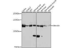Western blot analysis of extracts of various cell lines, using Vinculin Rabbit mAb (ABIN3016604, ABIN3016605, ABIN1680530 and ABIN1680531) at 1:1000 dilution. (Vinculin anticorps)