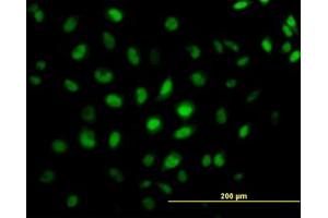 Image no. 4 for anti-CAMP Responsive Element Binding Protein 5 (CREB5) (AA 1-100) antibody (ABIN599087) (CREB5 anticorps  (AA 1-100))