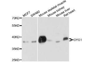 Western blot analysis of extracts of various cell lines, using GYG1 antibody. (Glycogenin 1 anticorps  (AA 234-333))