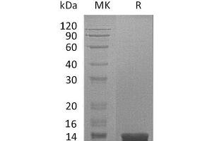 Western Blotting (WB) image for Macrophage Migration Inhibitory Factor (Glycosylation-Inhibiting Factor) (MIF) protein (His tag) (ABIN7320614)