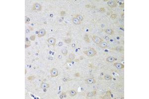 Immunohistochemistry of paraffin-embedded mouse brain using YES1 antibody at dilution of 1:100 (40x lens). (YES1 anticorps)