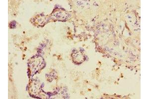 Immunohistochemistry of paraffin-embedded human placenta tissue using ABIN7160270 at dilution of 1:100 (DCP1A anticorps  (AA 303-582))