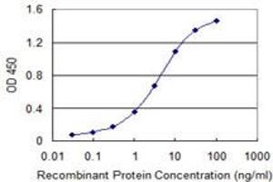 Detection limit for recombinant GST tagged SUOX is 0.