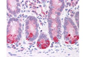 LRRC59 antibody was used for immunohistochemistry at a concentration of 4-8 ug/ml. (LRRC59 anticorps  (N-Term))