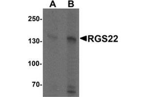 Western blot analysis of RGS22 in Jurkat cell lysate with RGS22 Antibody  at (A) 1 and (B) 2 μg/ml. (RGS22 anticorps  (N-Term))