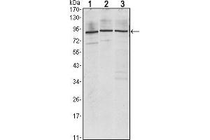 Western blot analysis using IGF2BP3 mouse mAb against Jurkat (1), K562 (2) and NTERA-2 (3) cell lysate. (IGF2BP3 anticorps)