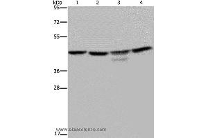 Western blot analysis of K562 and 293T cell, Jurkat cell and mouse brain tissue, using CSNK2A1 Polyclonal Antibody at dilution of 1:300 (CSNK2A1/CK II alpha anticorps)